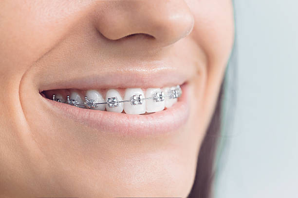Best Traditional Braces  in Enterprise, OR